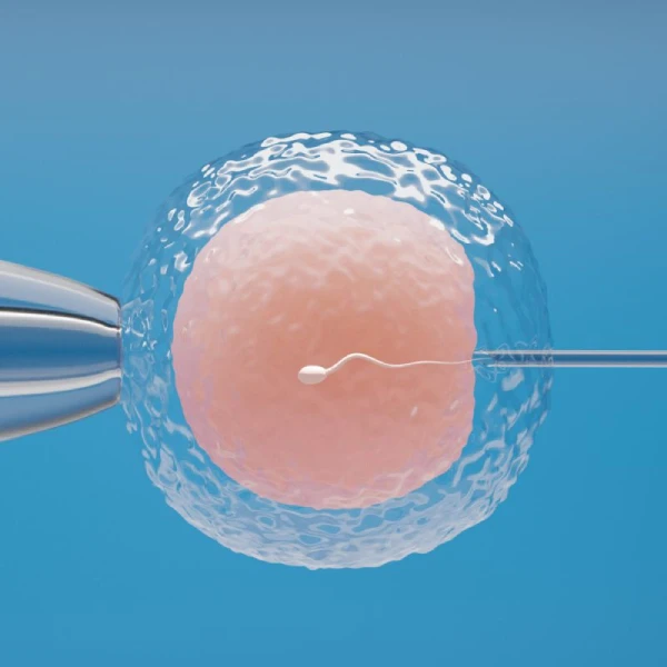 IUI Treatment at Yashoda IVF